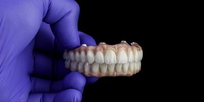Dental implants and dentures in close-up Siemke on a black background