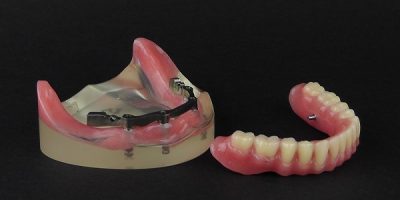 benefits_of_peek_prosthesis